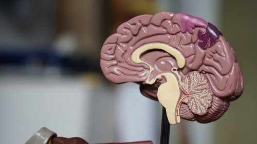 ¿Cómo cura el psicoanálisis? Un aporte de las neurociencias